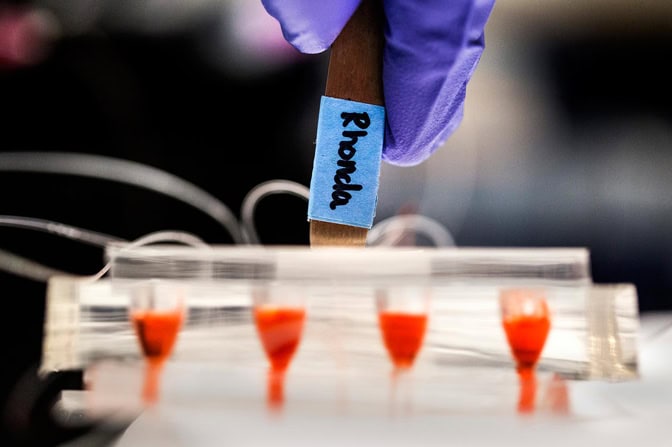 A blood sample reveals the spiral pattern in the microfluidic chip.