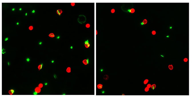 microscopic image of dyed white blood cells called neutrophils eating rods