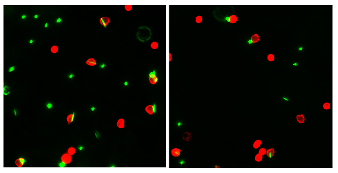 microscopic image of dyed white blood cells called neutrophils eating rods