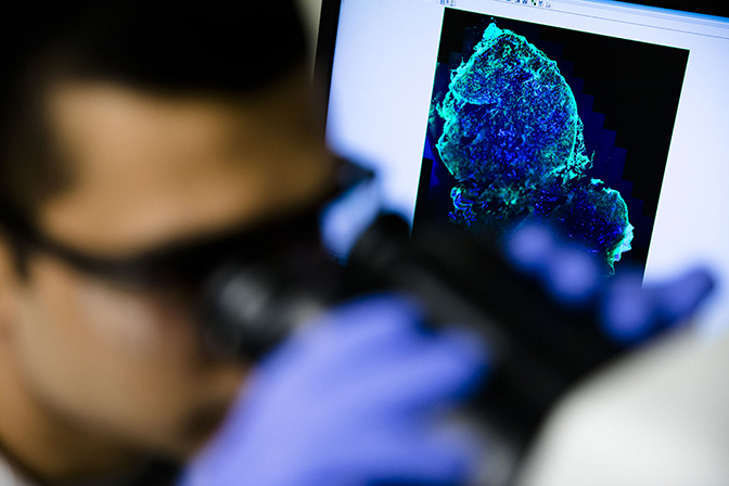 a close up shot of a phd student sumit bhatnagar inspecting and analyzing tumor cells under microscope