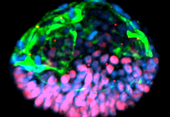 Image of green and pink stem cells in a cluster