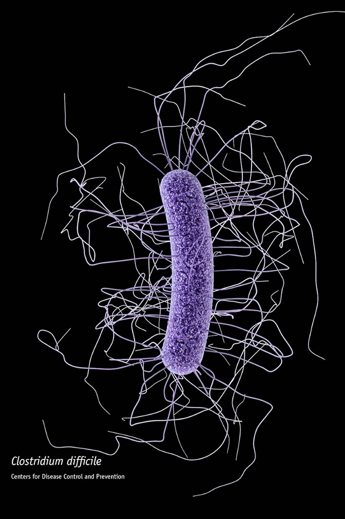 Simulated image of elongated clostridium difficile bacteria