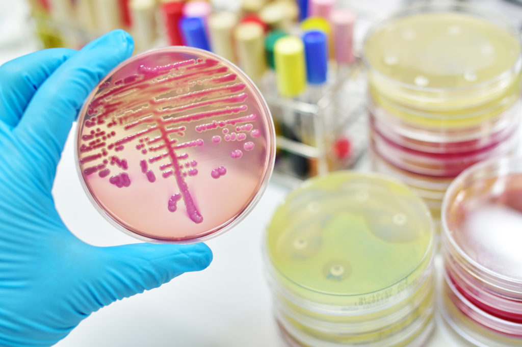 Hand holding petri dish with bacteria growing