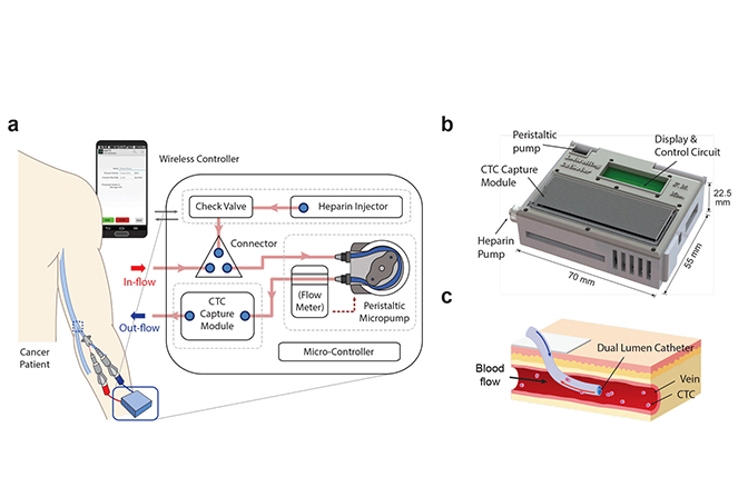 A digram illustrating how the device functions and how it is connected to the blood vessels.