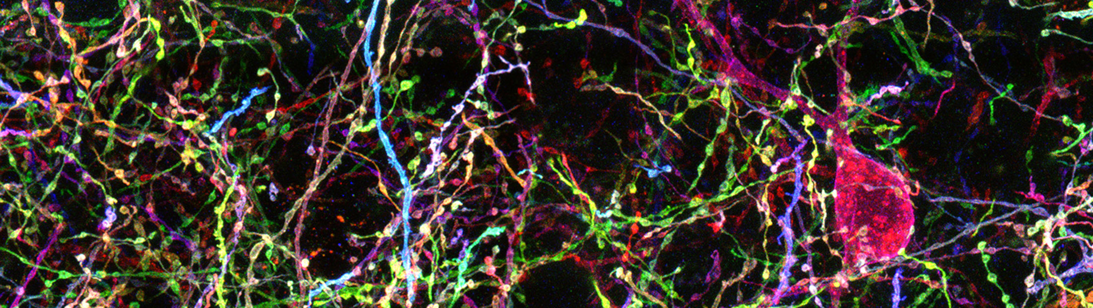 A multicolored network of neurons.