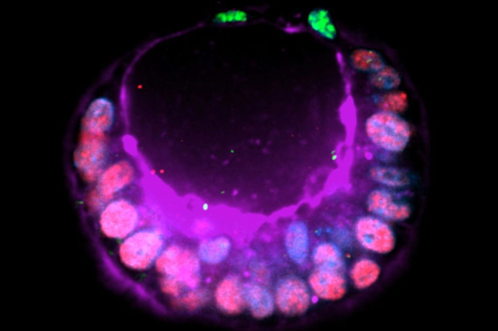 a purple and green embryo