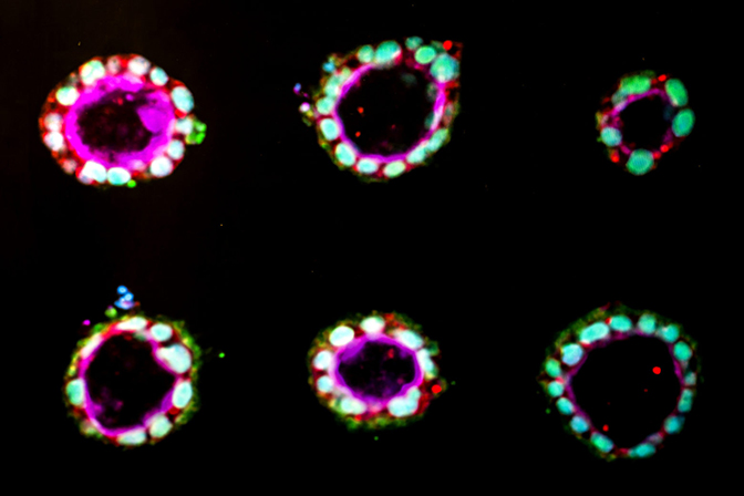 Six, circular, bright pink and green shapes on a black background.