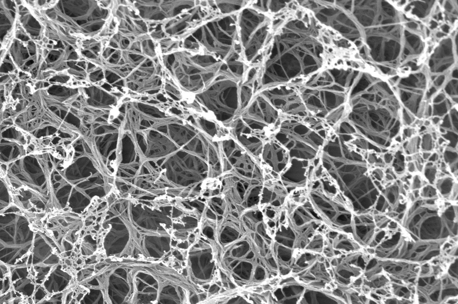 An electron microscope image of the synthetic cartilage matrix