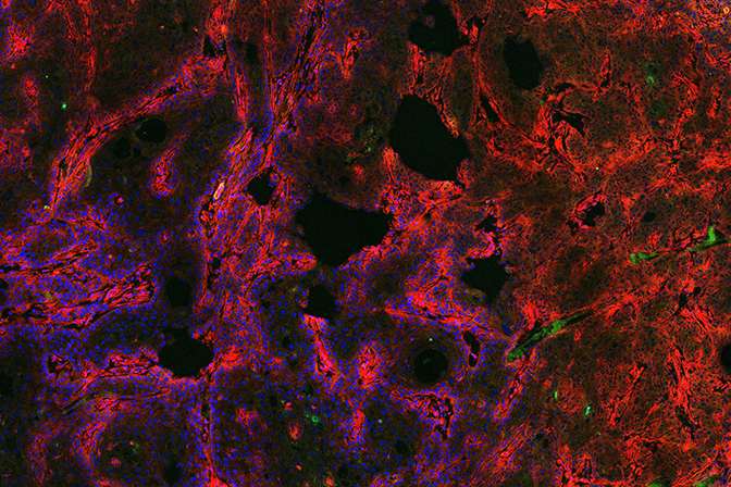 a microscopic image of a human tumor xenograft with a fluorescent red dye that reveals cancerous cells on tumors