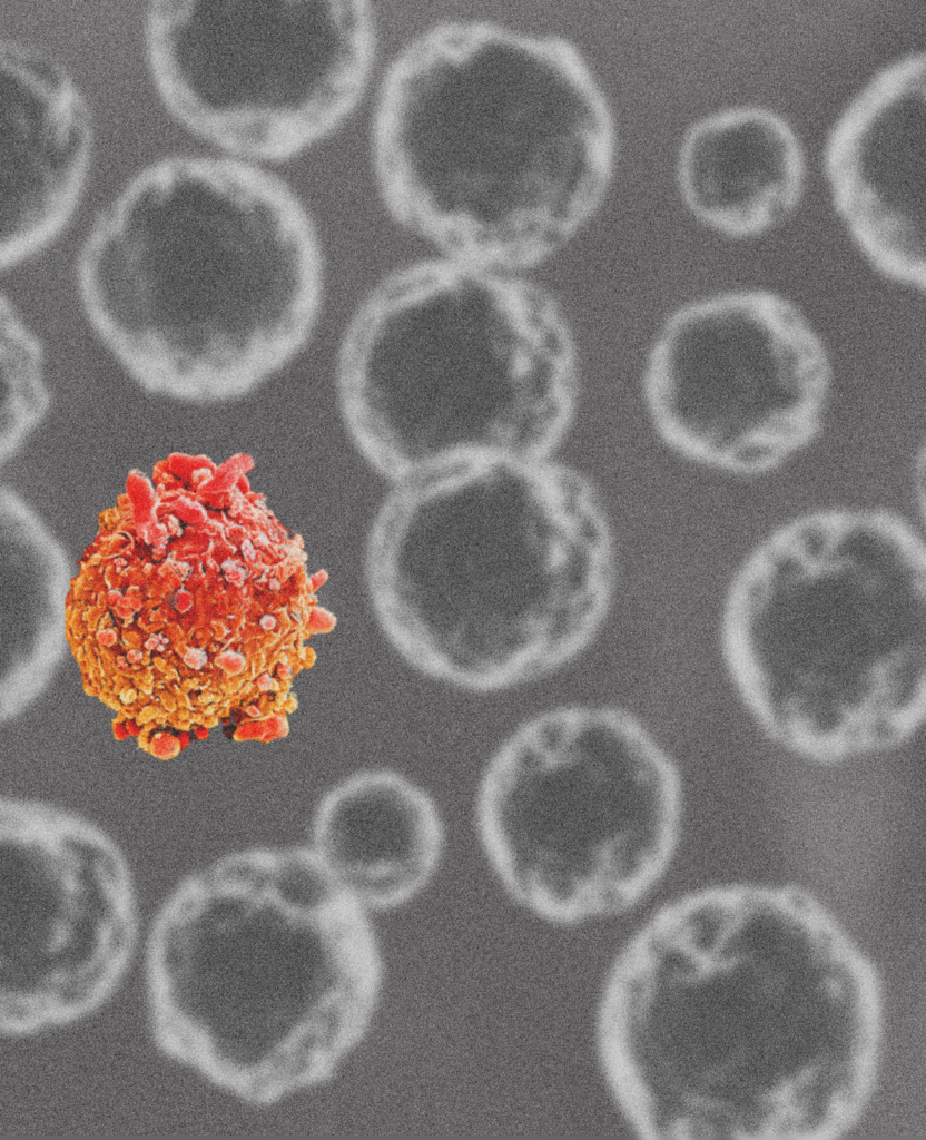 A red cell with protrusions among lots of gray cells.