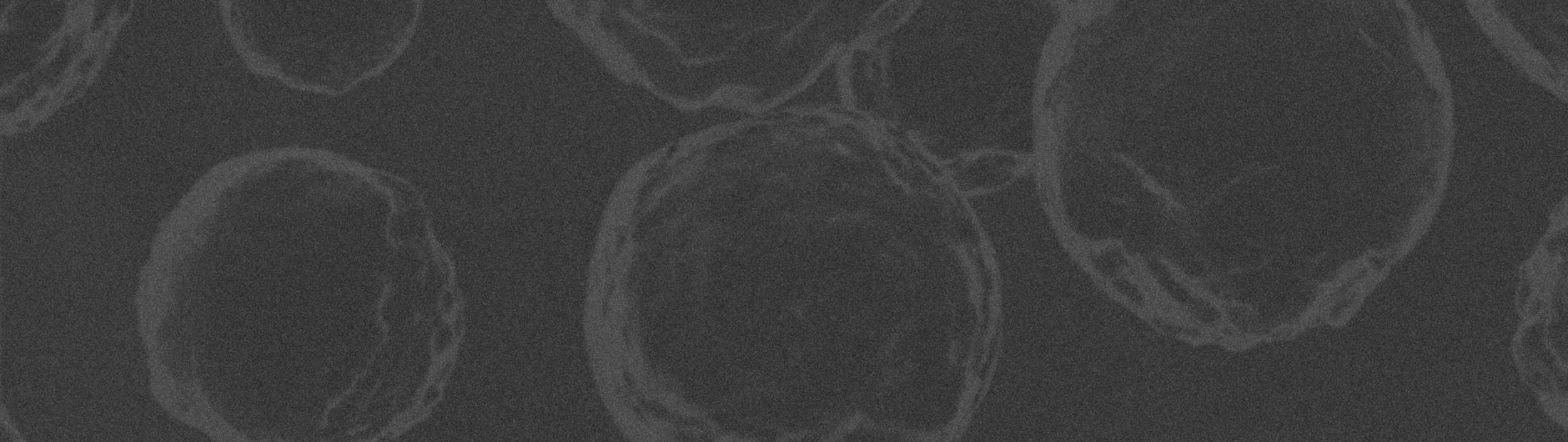 Grayscale microscope image of cells.