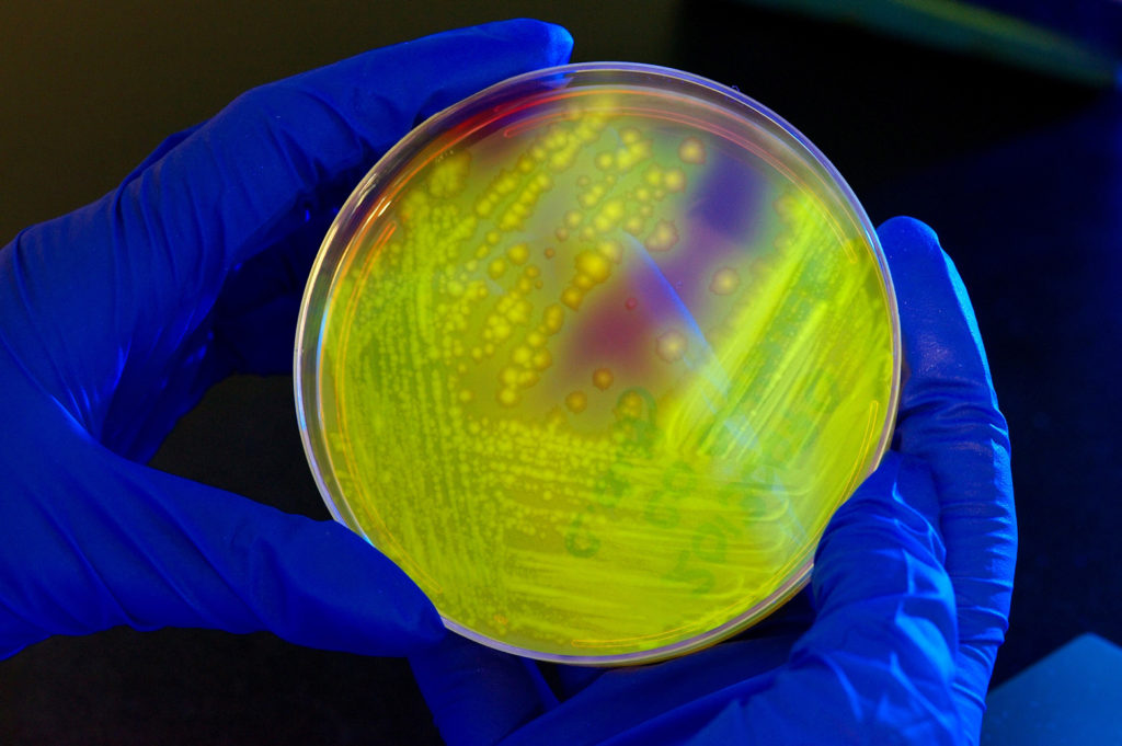 Close up of petri dish containing bacteria held by researcher