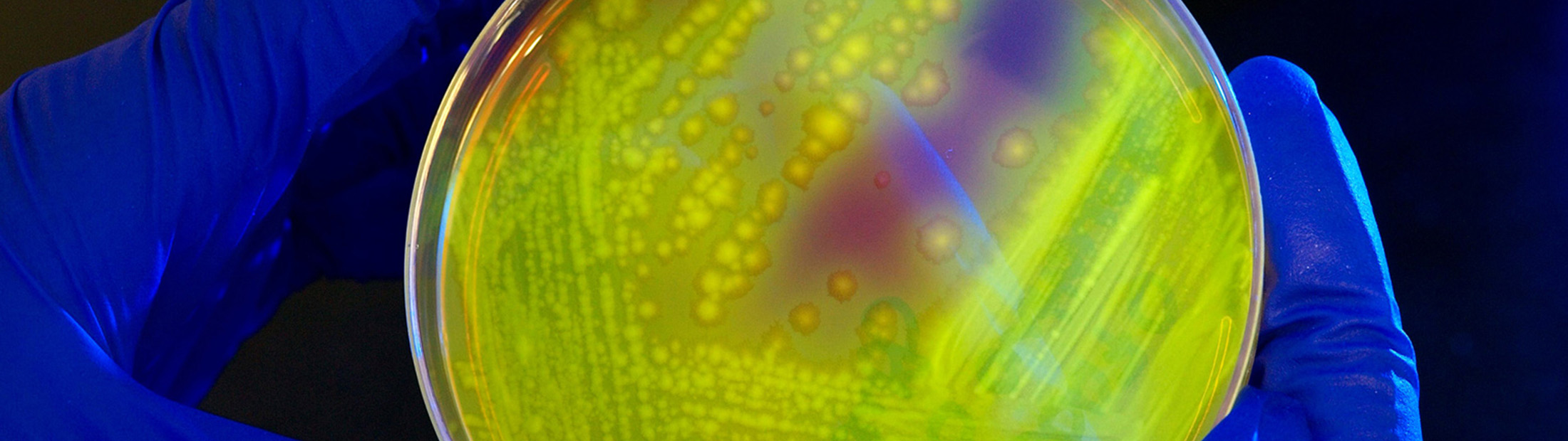 Close up of petri dish containing bacteria held by researcher