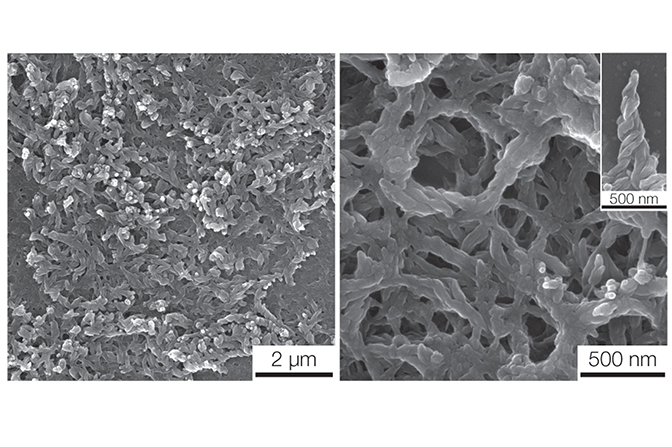 Two side-by-side grayscale microscope images of a network of fibers.