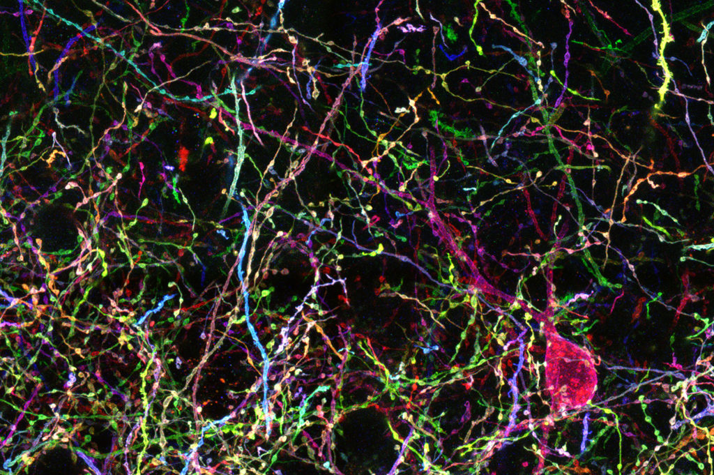 A multicolored network of neurons.