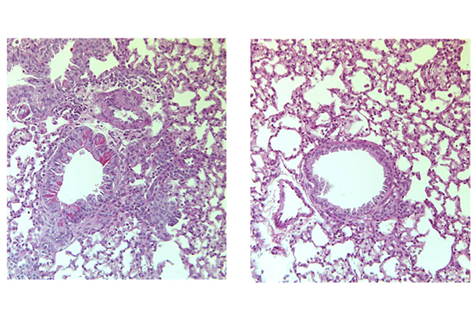 Side by side microscope images of tissue.