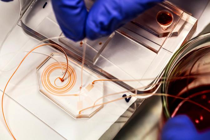 A blood sample reveals the spiral pattern in the microfluidic chip.