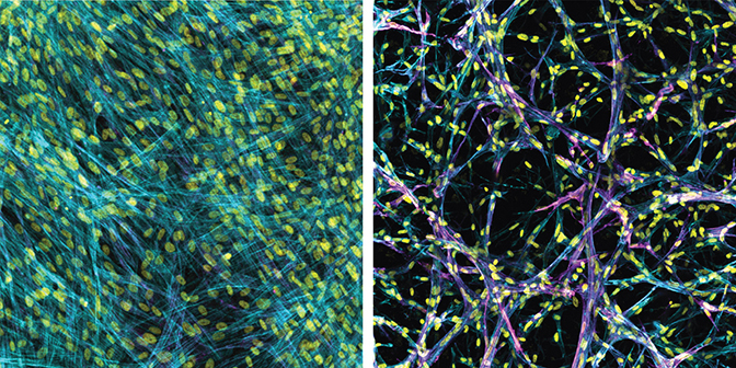 Two images of 2D versus 3D myofibroblasts