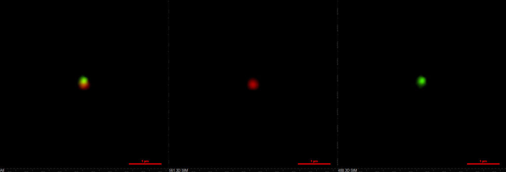 The two-compartment nanoparticles as seen with fluorescence microscopy.