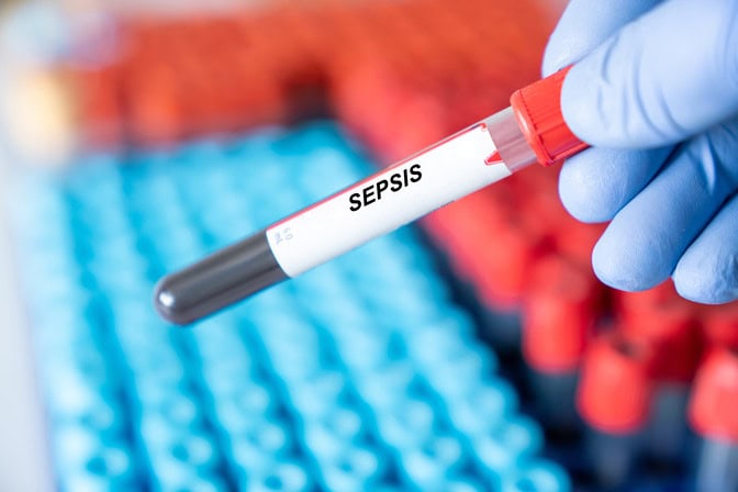 A gloved hand holds a test tube labeled "Sepsis" with blood inside, in front of a background of test tubes.