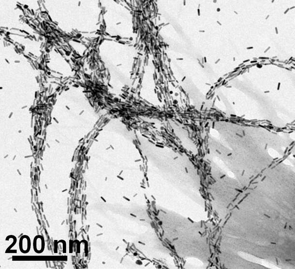 Networks of proteins thread across the gray-scale image. Each thread is coated in gray and black rods, like candy on a Nerds rope, and each rod is about 20 nanometers long and 10 nanometers wide.