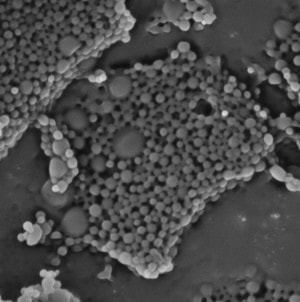 Scanning electron microscopy image: Clusters of tiny gray spheres surround larger spheres.