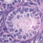 An immature human egg at the "secondary follicle" stage of development, resembling a pink circle with purple ovals inside it.