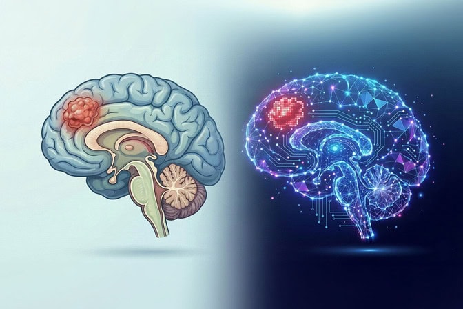 Left: a brain in the style of a medical illustration with the tumor in the frontal cortex. Right: the same brain in a 'digital' illustration style contains a pixelated tumor in the same spot.