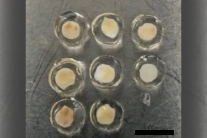 Close up of eight samples of human ovarian tissue encapsulated in a transparent immune-isolating hydrogel.