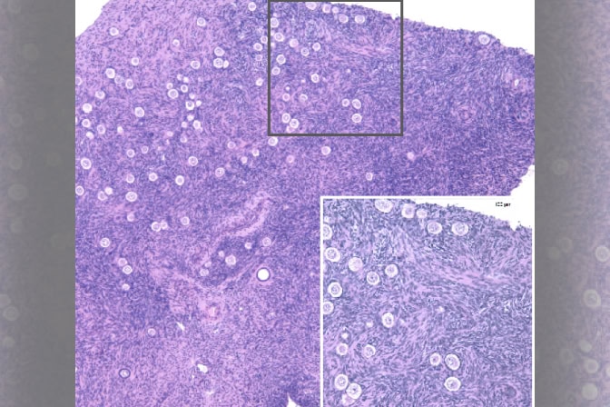 Hundreds of white circles appear against a purple backdrop.