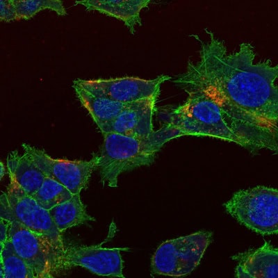 Fluorescent green cells with large, blue cores are arranged on a black background. There are many red dots throughout the green parts of the cells. In some cells, the red dots are grouped around or found inside the blue core.