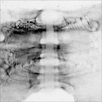 A black and white proton radiograph of an exploding aluminum wire. The white vertical structure in the center is due to the dense core of aluminum wire.
