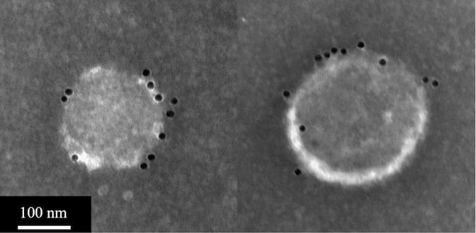 Vaccine particles look like light gray circles in the grayscale microscope image. Several small black dots speckle the edges of the particles. A scale bar shows that the particles are about 100 nanometers wide.