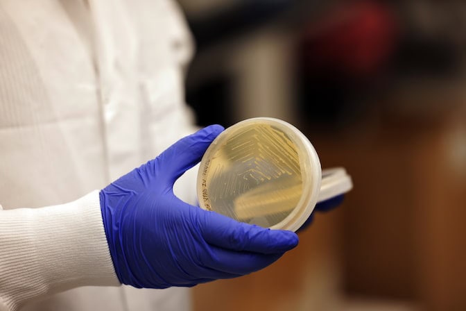 A round petri dish has streaks of yellow where the yeast is growing. The hand holding the dish wears a purple nitrile glove.