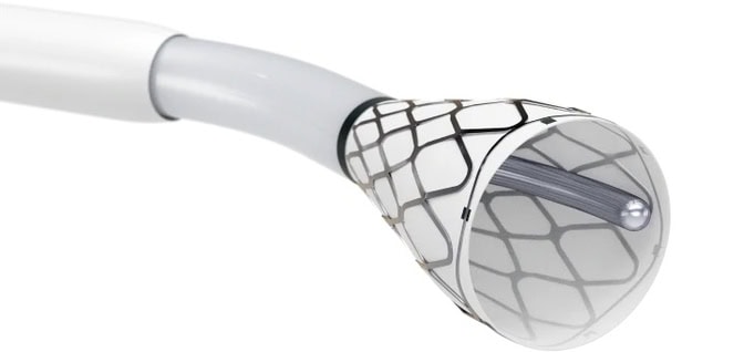 A graphic illustration of a endovascular device that has a cone that is sheathed in a flexible metal mesh that holds it open, revealing a metal rod angled to one side of the opening.